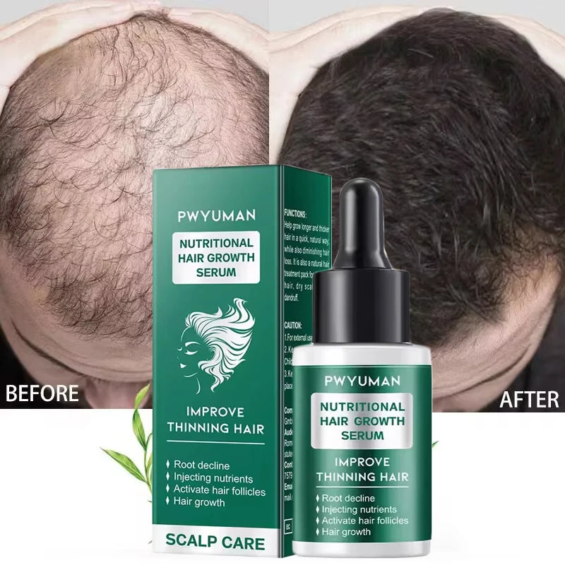 Ginger Hair Oil with Scalp and Shampoo Routine References, Cosmetic Hair Care Serum for Women and Men with Single and Promotional Purchase Options