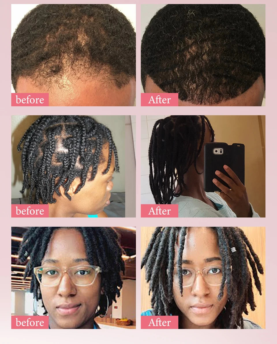 Hair Care Oil and Cream Options with Karkar, Chebe, Batana and Rosemary References, Single 40ml Oil, Single 60g Cream or Set and gift for Cosmetic Grooming