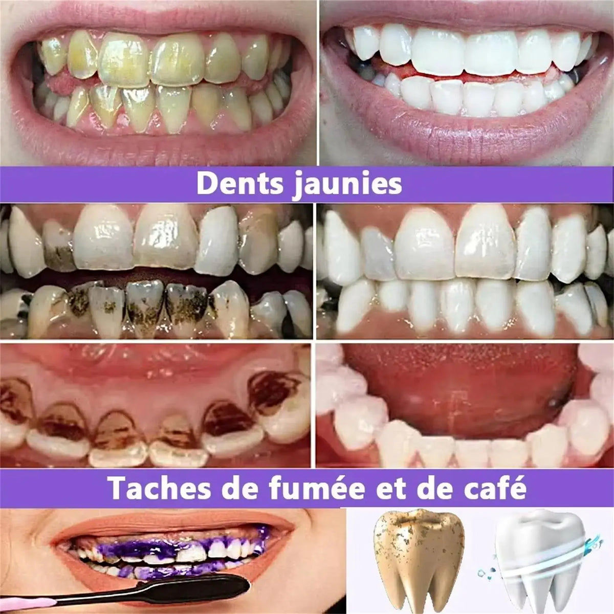 Purple Teeth Care Solution with 30g or 50g Single-Piece Options and Separate Multipack Labels for Label-Guided Adult Oral Care Product Selection