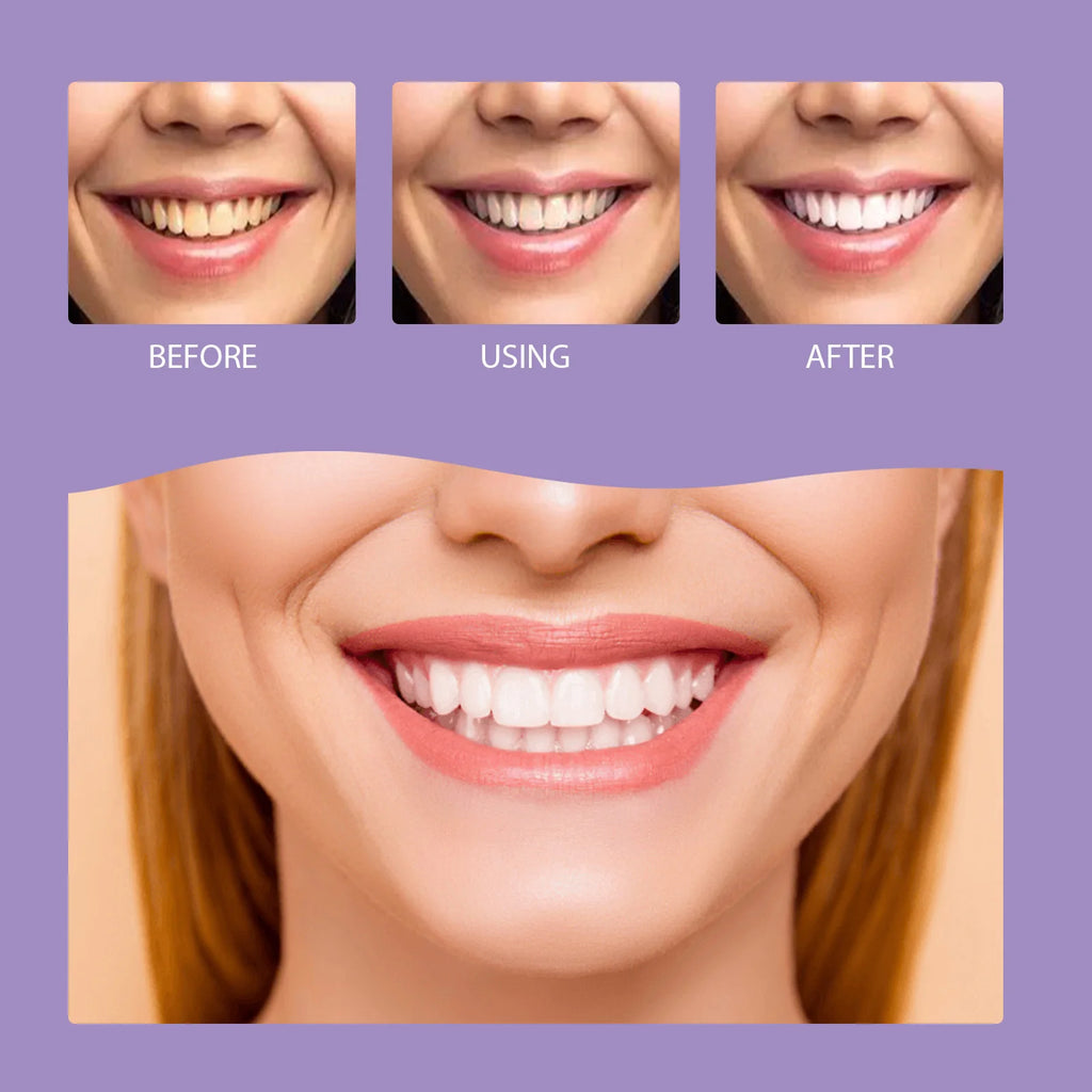 Purple Teeth Care Solution with 30g or 50g Single-Piece Options and Separate Multipack Labels for Label-Guided Adult Oral Care Product Selection
