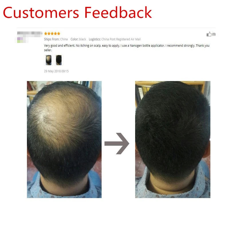 Hair Building Fiber Powder with Ten Shade Options from Black to White, Sevich Source Reference and Applicator Spray Wording for Cosmetic Hair Appearance
