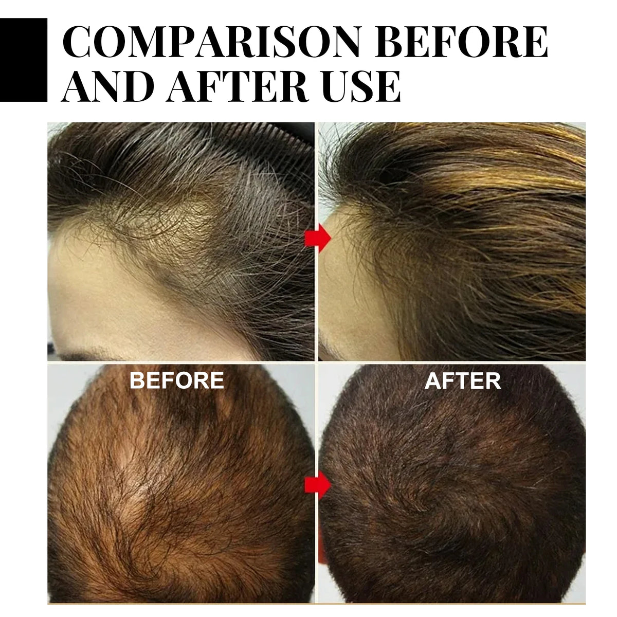 Chebe Hair Conditioning Oil with Spray, Mask and Three-Piece Option Labels, Moisture-Focused Cosmetic Hair Care for At-Home Grooming Routines