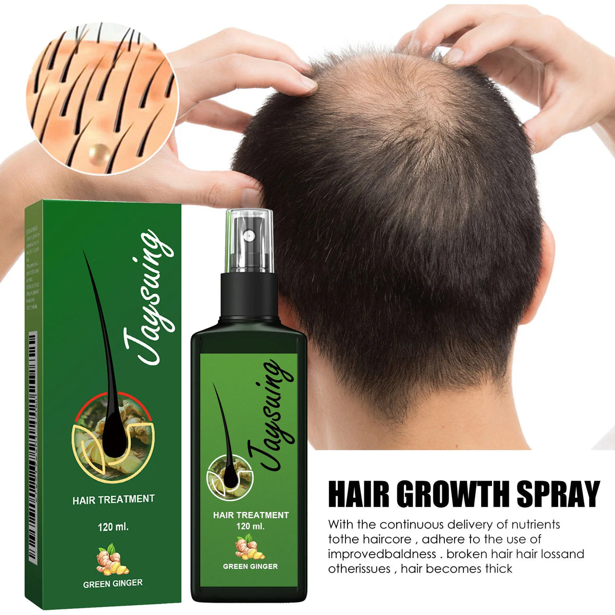 Ginger Scalp Care Spray for At-Home Hair and Scalp Massage Routines, with 30ml and 120ml Size Choices plus a Two-Piece Option