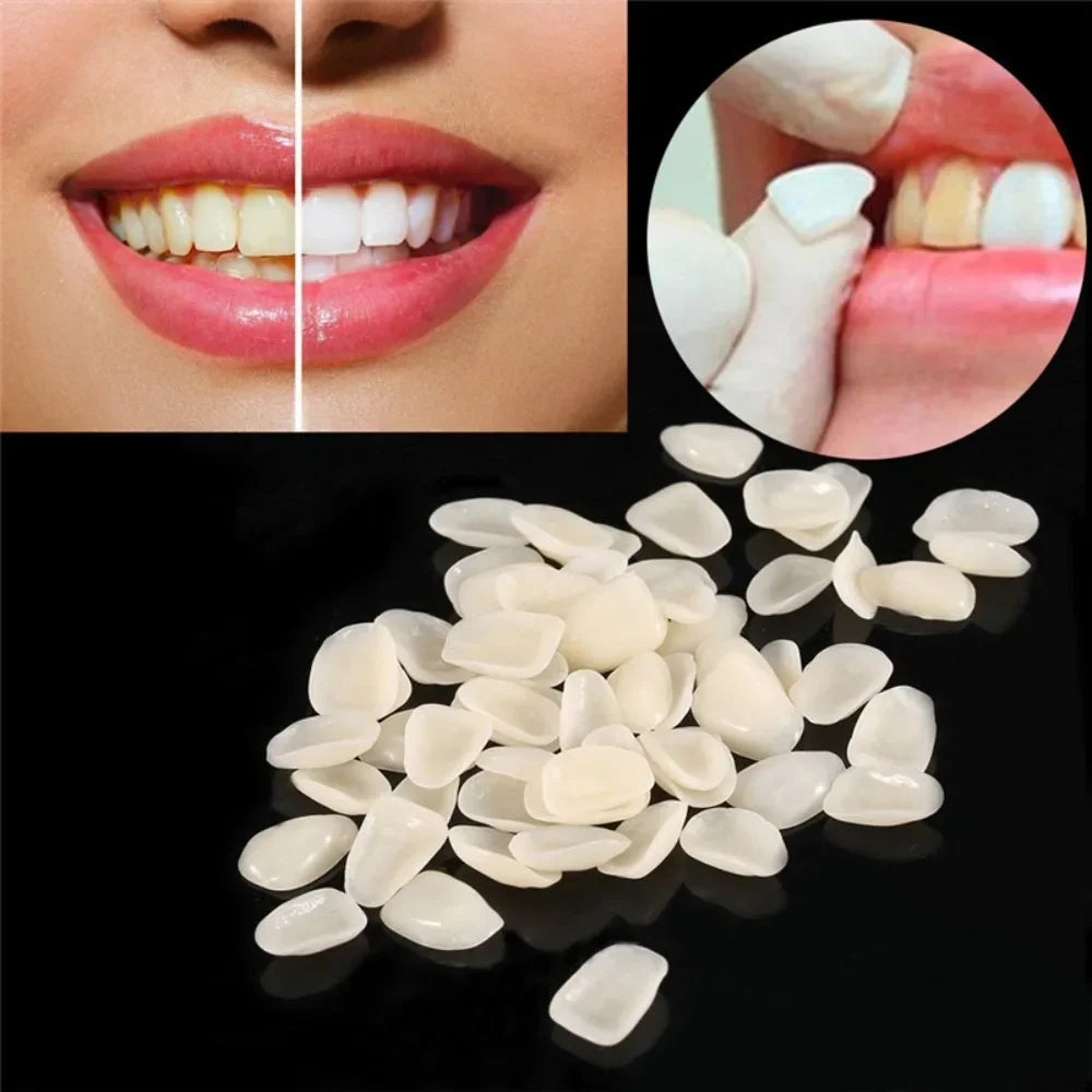 Temporary Dental Veneer Pieces for Front Teeth, Mixed-Size Cosmetic Cover Listing in Slightly White or Slightly Yellow Options for Professional Dental Review