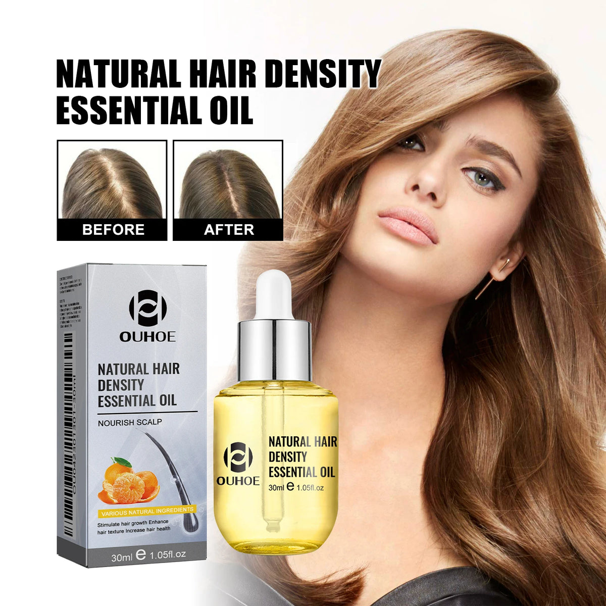Scalp Massage Hair Oil by OUHOE, 30ml Cosmetic Hair Care with Citrus, Ginger and Ginseng, Dropper Bottle for Men and Women at Home
