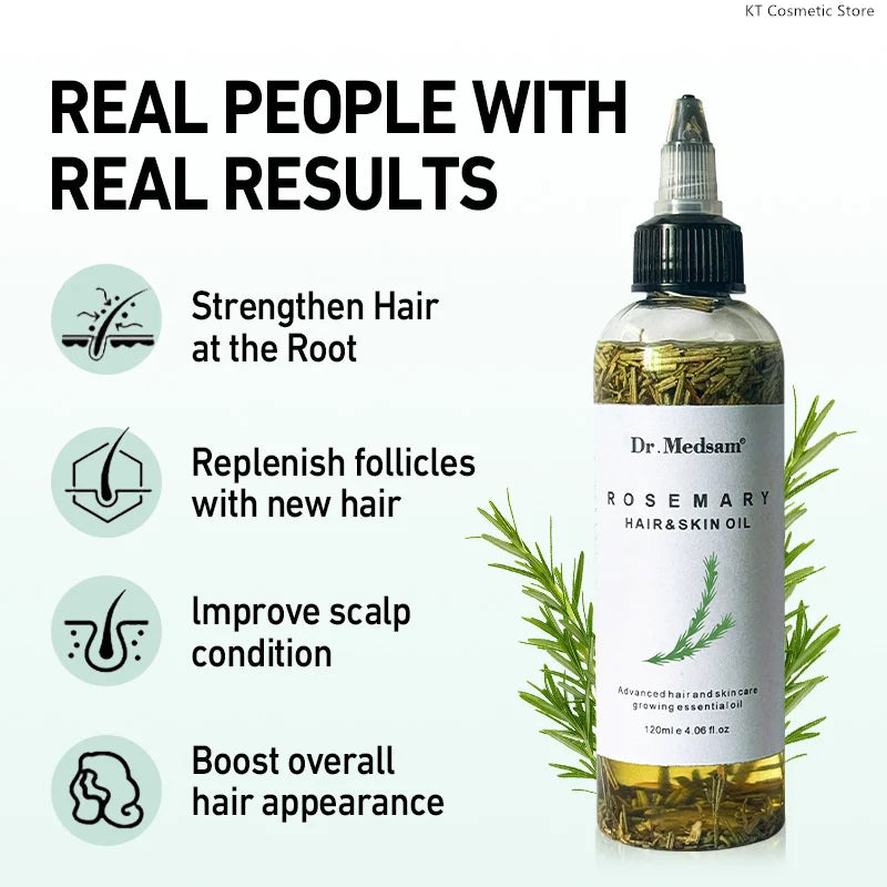 Rosemary Extract Hair Serum, 100ml Cosmetic Scalp and Hair Care with Listed Biotin, Vitamin B5, Coconut and Grape Seed Oils for Men and Women