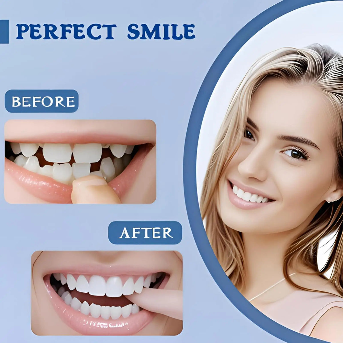 Adjustable Snap-On Teeth Kit with One-, Three- or Five-Box Option Labels for Cosmetic Appearance Consideration, with Dental Suitability and Fit Requiring Review
