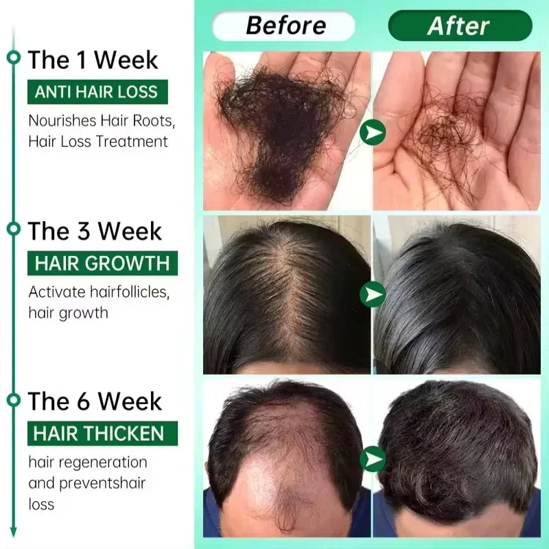 Hair Care Serum with Ginger Reference, Listed 30ml Scalp and Hair Grooming Product for Men and Women, At-Home Personal Care Routine