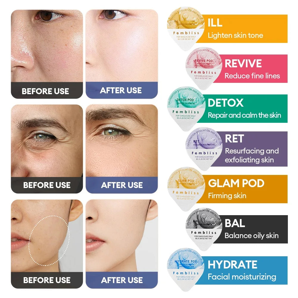 Facial Pod Serum and Gel Kit with Listed Six 8g Pods, Six 8ml Serums and Six 15ml Gels, Seven Type Choices and Separate Bubble Pen Option