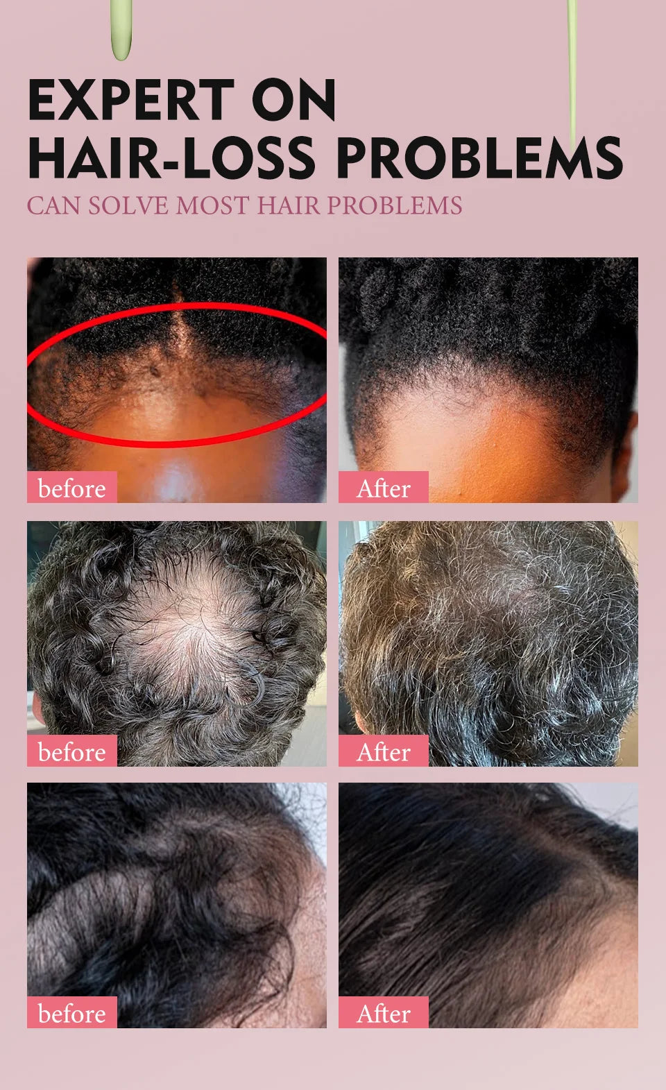 Hair Care Oil and Cream Options with Karkar, Chebe, Batana and Rosemary References, Single 40ml Oil, Single 60g Cream or Set and gift for Cosmetic Grooming
