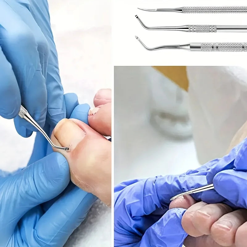 Nail Cleaning Tool Set, Three-Piece Manual Manicure and Pedicure Selection with Multifunctional File References for Adult Personal Grooming Routines