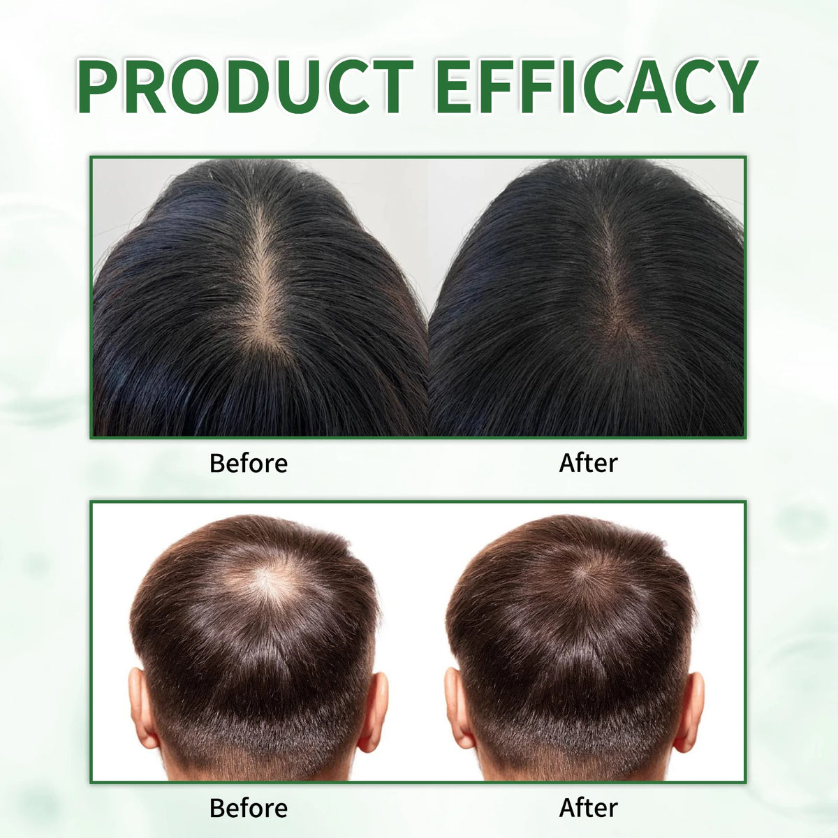 Batana Oil Shampoo Set with Listed Hair Oil, Rosemary Leaf Oil Shampoo Formula for Everyday Cleansing and Cosmetic Hair Conditioning at Home
