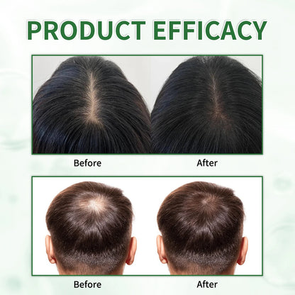 Batana Oil Shampoo Set with Listed Hair Oil, Rosemary Leaf Oil Shampoo Formula for Everyday Cleansing and Cosmetic Hair Conditioning at Home