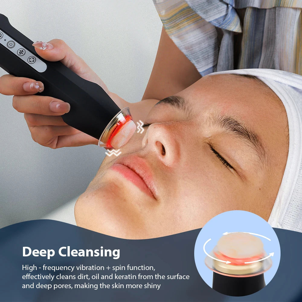 Facial Bubble Pen Machine Only with Five Vibration and Spin Levels, Eight LED Modes, White or Black Handheld Device, Care Kit Sold Separately