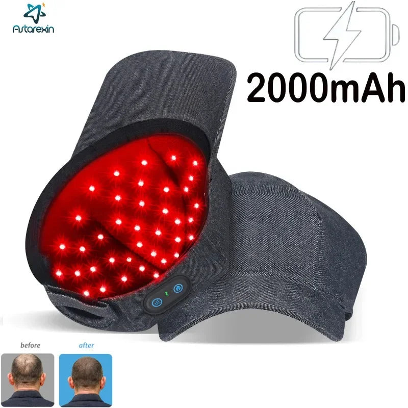 LED Light Scalp Cap with Normal, Breathing, 10Hz and 40Hz Mode References, Listed Rechargeable 2000mAh Battery and Black or Grey Regional Plug Options