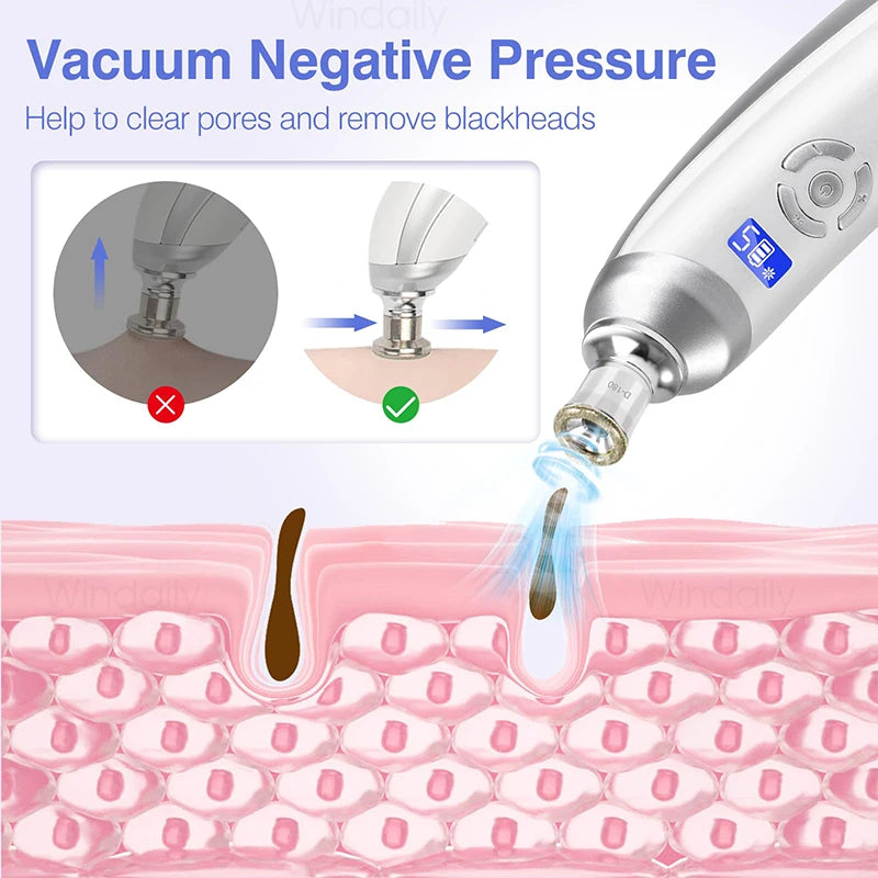 Cordless Diamond Microdermabrasion Device with Replaceable Tip References, Nine-Head Five-Level or Four-Head Three-Level Options for Adult Facial Beauty Routines