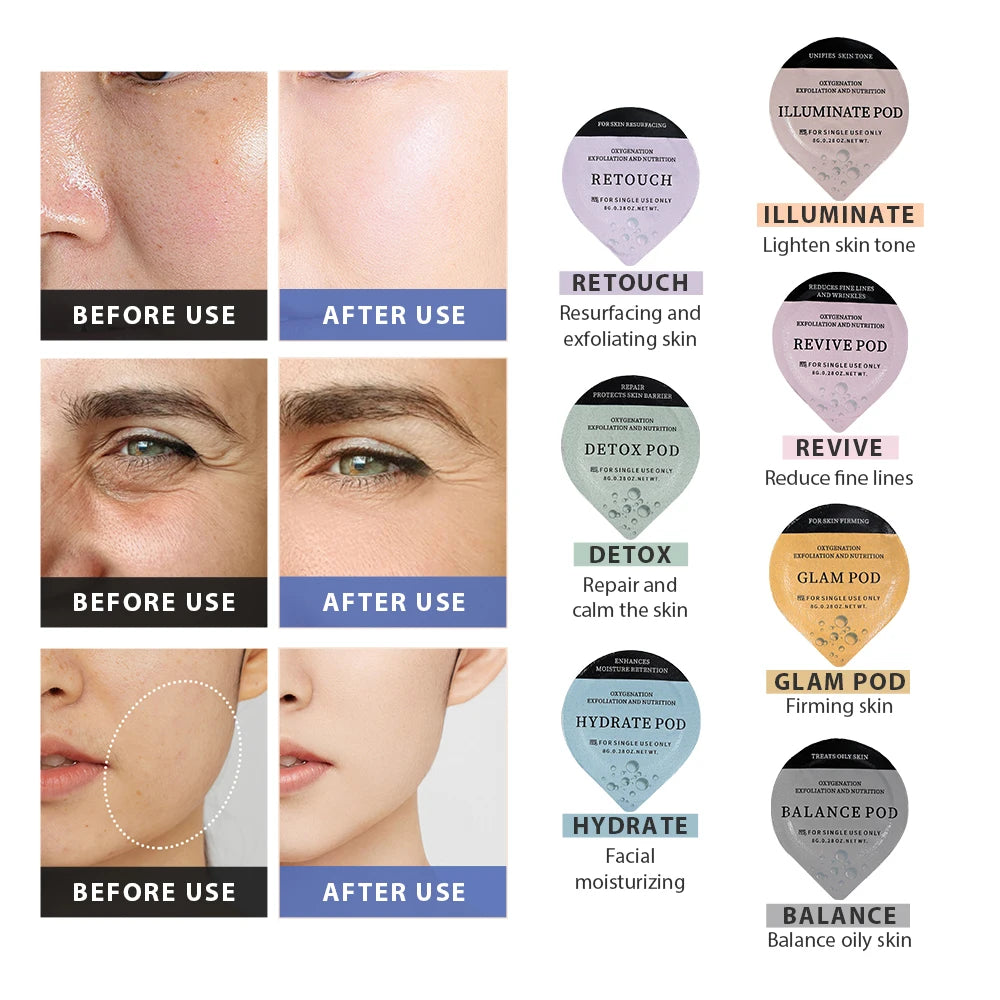 Glam Facial Pod and Capsule Gel Options for Compatible Aqua Bubble Devices, Seven Numbered Type Selections and a Separate Facial CO2 Machine Option