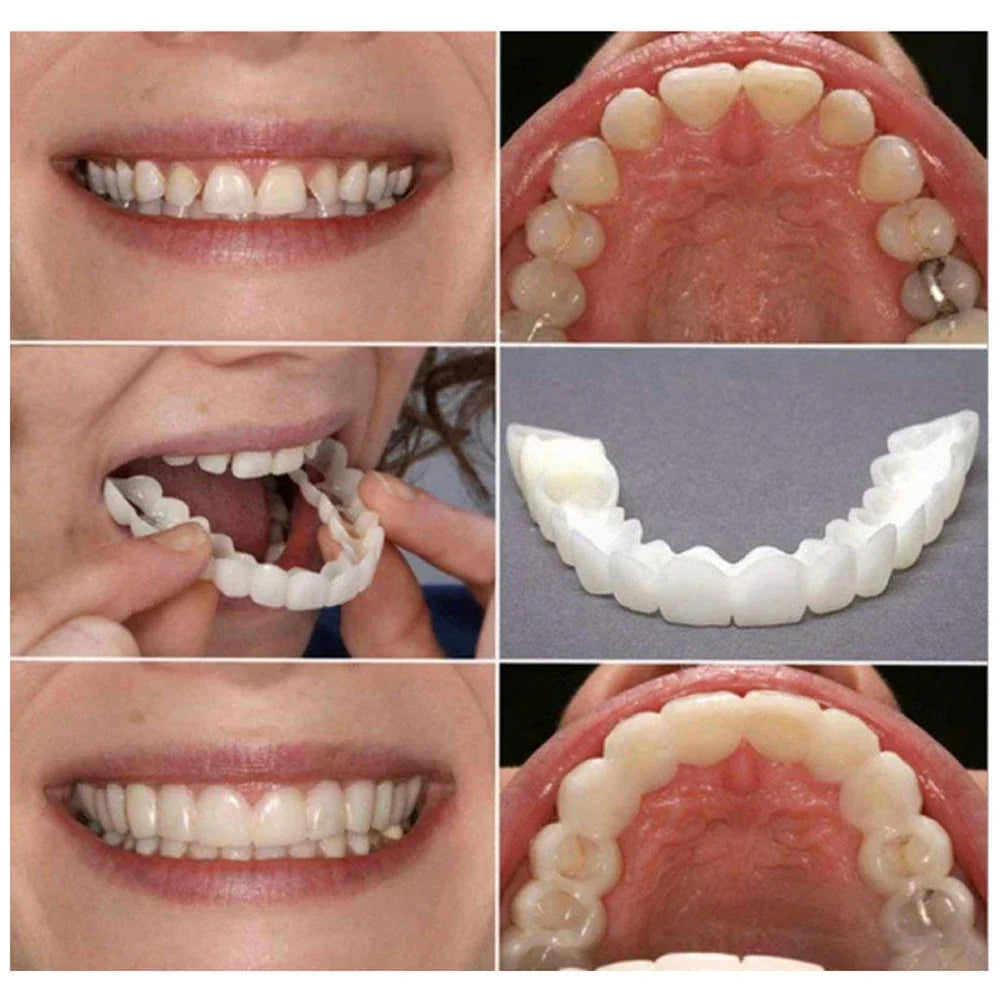 White Cosmetic Teeth Cover, Temporary False-Teeth Appearance and Denture-Style Listing with Material, Fit and Retention Requiring Professional Dental Review