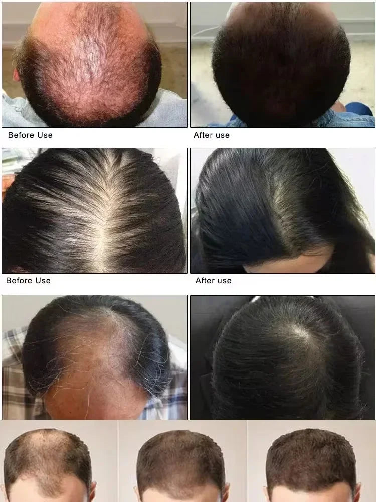 Batana Oil Hair Care for Women and Men, Cosmetic Conditioning Routine with Single and Multipack Option Labels for At-Home Grooming