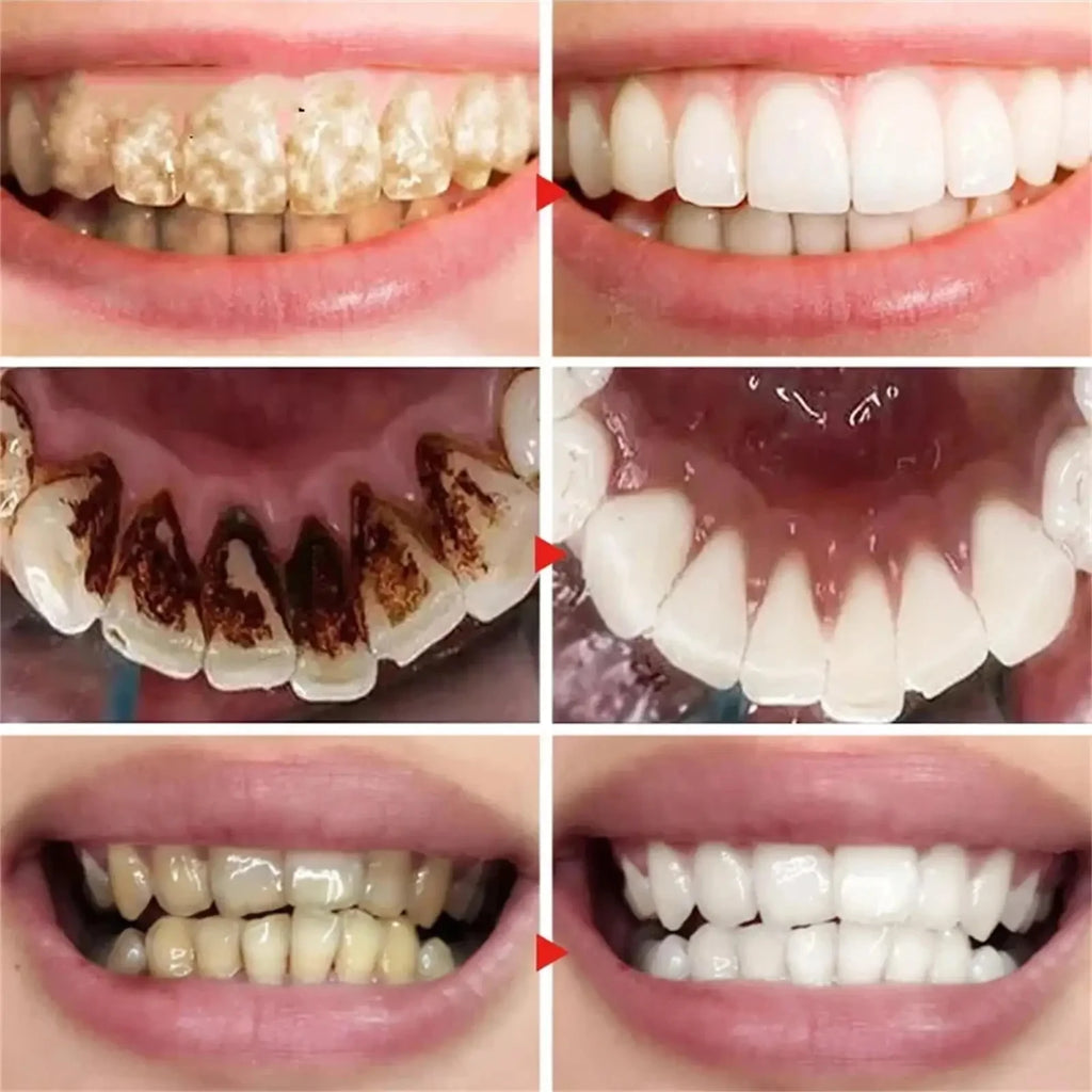 V34 Purple Toothpaste Serum with Color-Correcting Concept, 1-Piece, 2-Piece or Seven-Piece Box Options for Label-Guided Adult Oral Care Routines