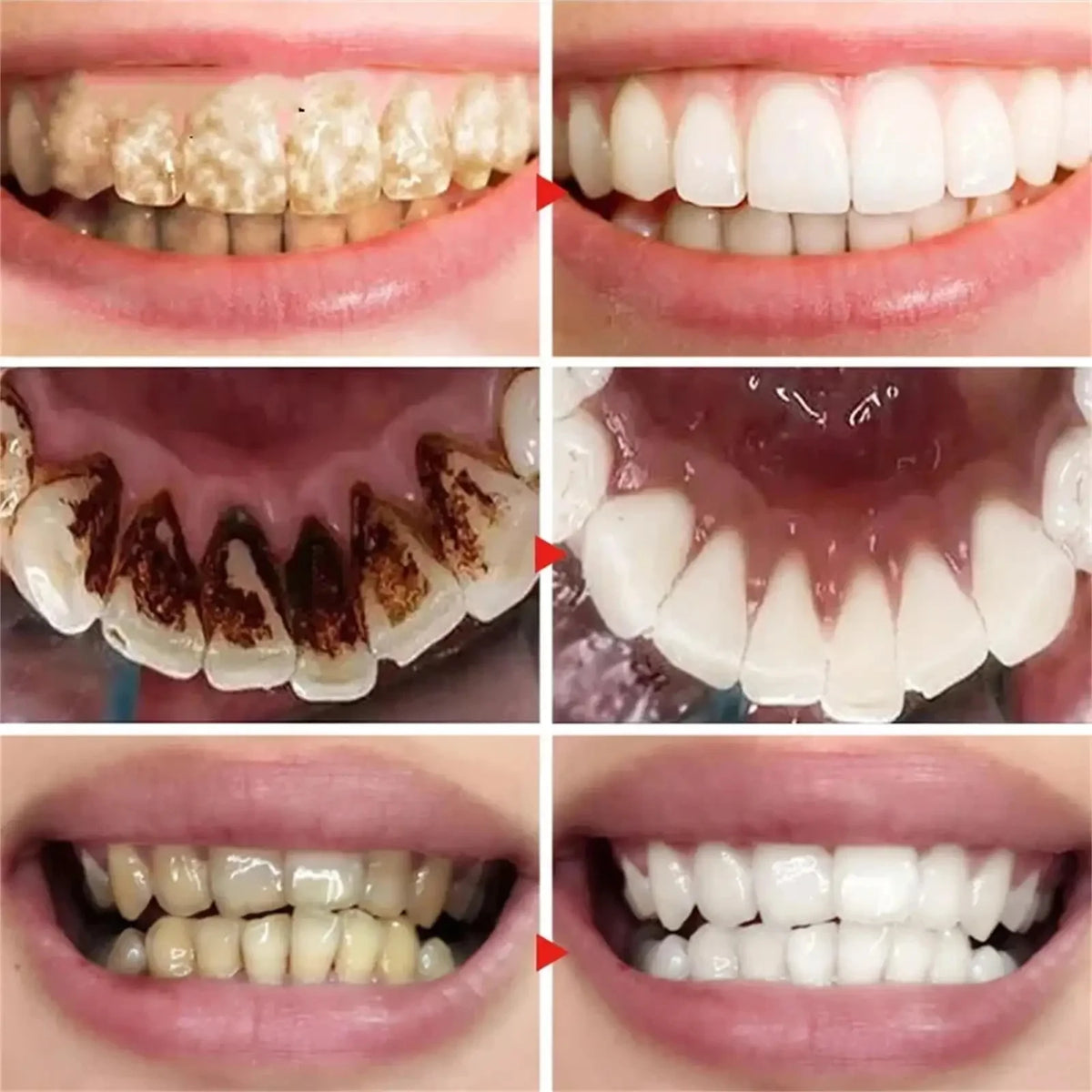 V34 Purple Toothpaste Serum with Color-Correcting Concept, 1-Piece, 2-Piece or Seven-Piece Box Options for Label-Guided Adult Oral Care Routines