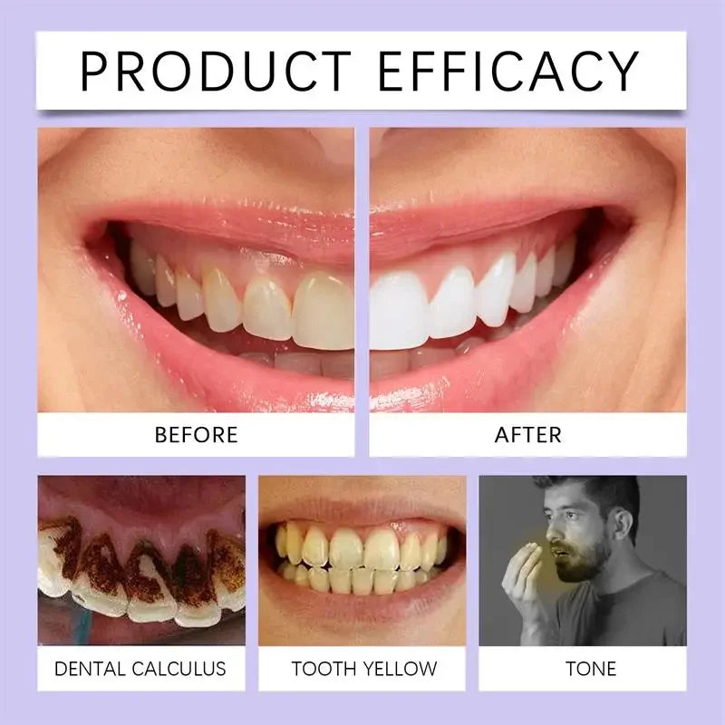 Teeth Whitening Pen with One, Three or Five-Piece Pack Options and Source Gel References for Label-Guided Adult Cosmetic Oral Care Selection