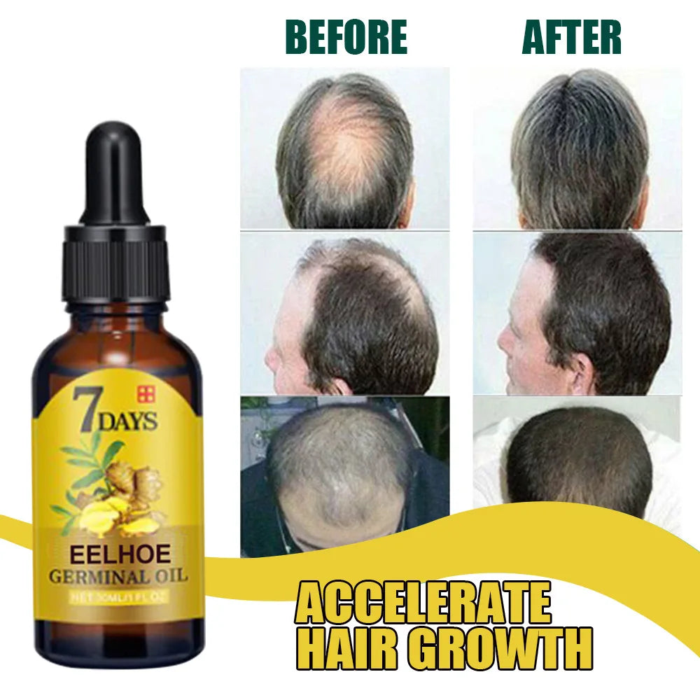 Ginger Hair Oil for Scalp Massage by EELHOE, Cosmetic Hair Care Serum for Men and Women in 10ml, 20ml and 40ml Size Options for At-Home Routines