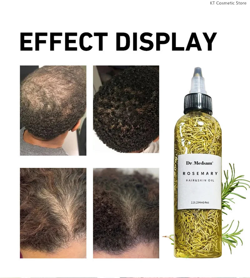 Rosemary Extract Hair Serum, 100ml Cosmetic Scalp and Hair Care with Listed Biotin, Vitamin B5, Coconut and Grape Seed Oils for Men and Women