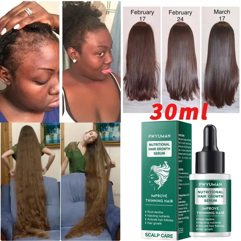 Ginger Hair Oil with Scalp and Shampoo Routine References, Cosmetic Hair Care Serum for Women and Men with Single and Promotional Purchase Options