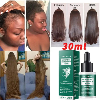 Ginger Hair Oil with Scalp and Shampoo Routine References, Cosmetic Hair Care Serum for Women and Men with Single and Promotional Purchase Options