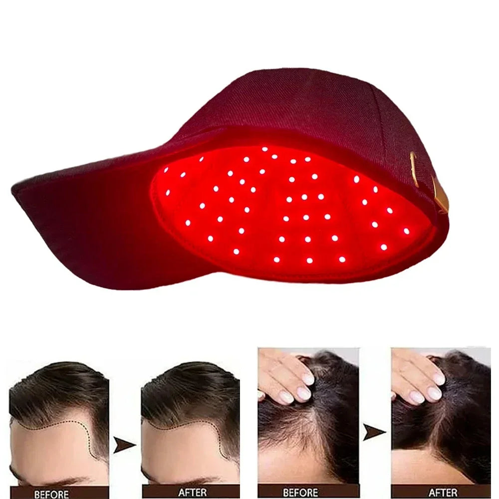 USB-Powered Red Light Scalp Cap with 96 Listed LEDs, 660nm and 850nm Wavelengths, Three Timer Settings and Separate Light Panel Option