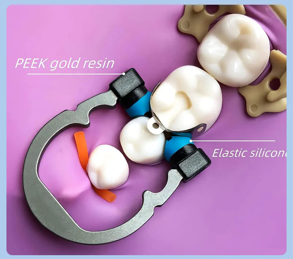 Dental Sectional Matrix Ring Options by AZDENT, Nickel-Titanium Clamping Rings with Silicone Contact Areas, Single and Combination Kit Selections