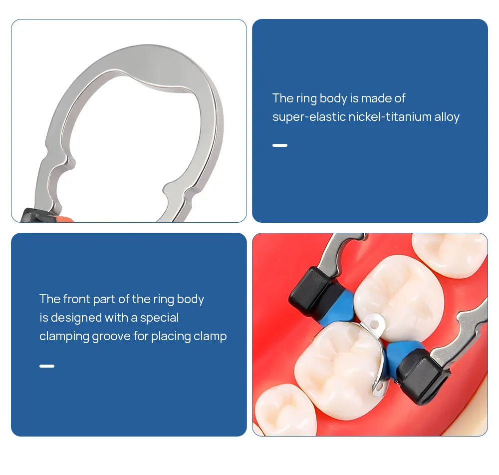 Dental Sectional Matrix Ring Options by AZDENT, Nickel-Titanium Clamping Rings with Silicone Contact Areas, Single and Combination Kit Selections