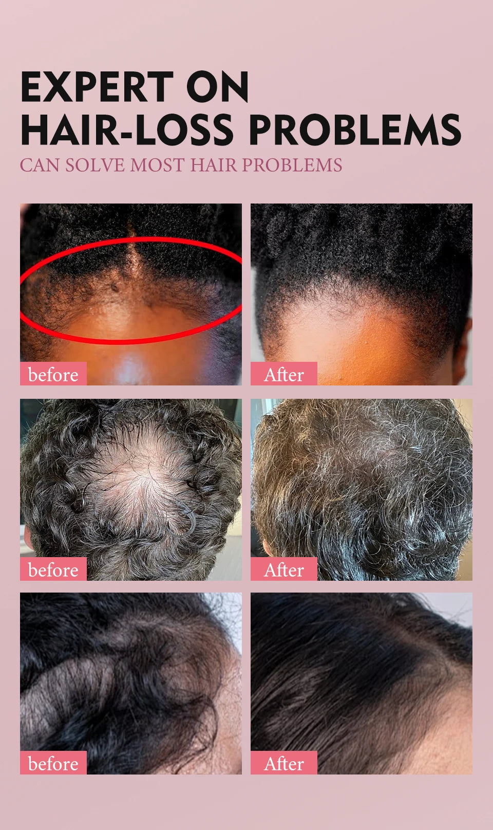 Hair Care Oil and Cream Options with Karkar, Chebe, Batana and Rosemary References, Single 40ml Oil, Single 60g Cream or Set and gift for Cosmetic Grooming