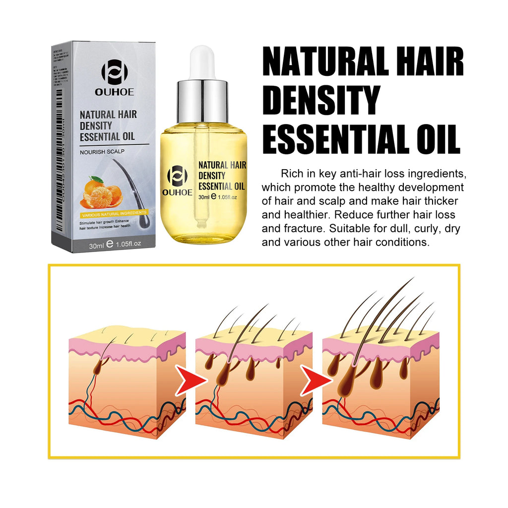 Scalp Massage Hair Oil by OUHOE, 30ml Cosmetic Hair Care with Citrus, Ginger and Ginseng, Dropper Bottle for Men and Women at Home