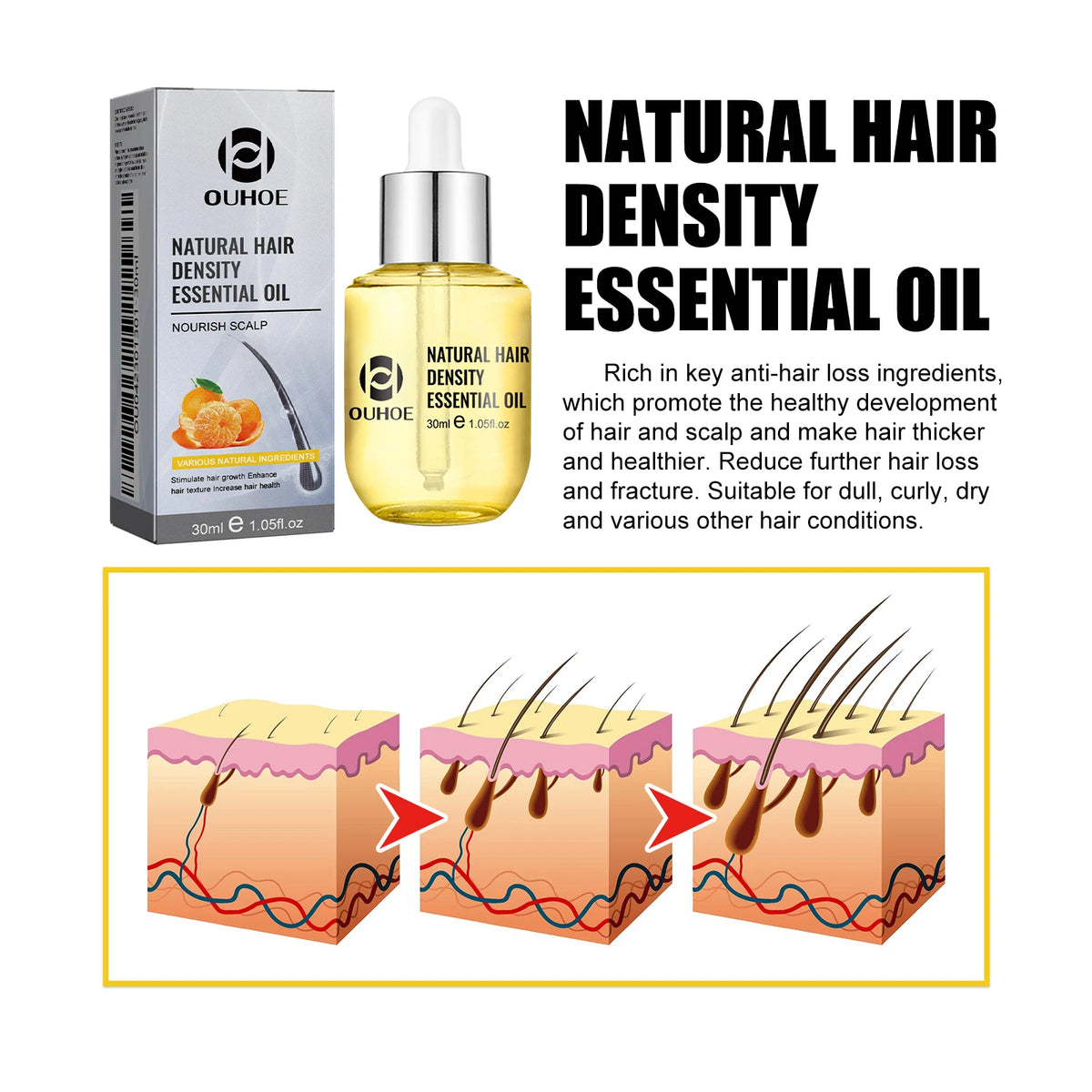 Scalp Massage Hair Oil by OUHOE, 30ml Cosmetic Hair Care with Citrus, Ginger and Ginseng, Dropper Bottle for Men and Women at Home