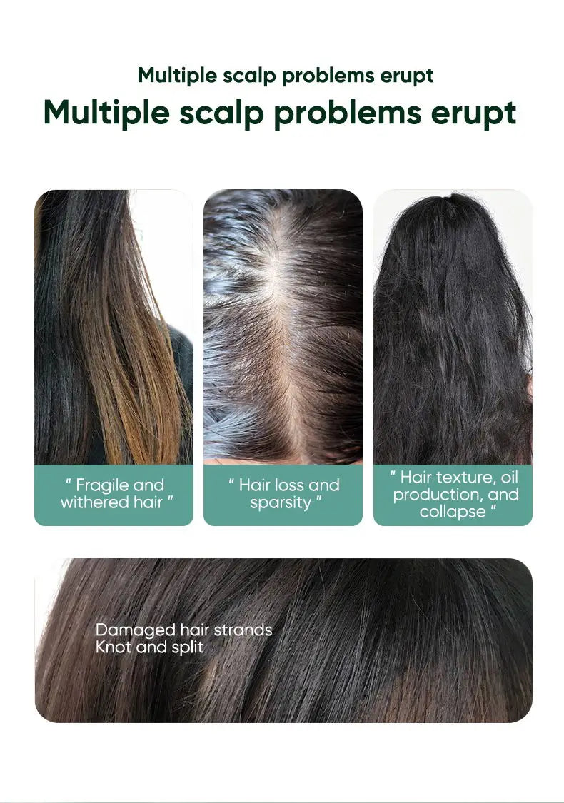 Ginger Hair Oil with Scalp and Shampoo Routine References, Cosmetic Hair Care Serum for Women and Men with Single and Promotional Purchase Options