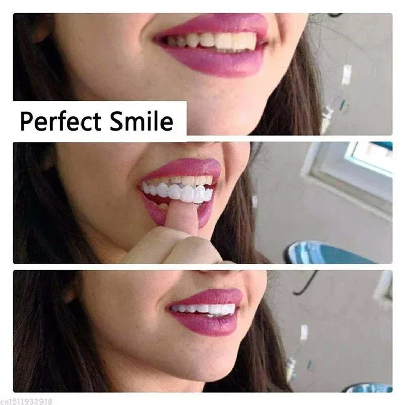 Silicone Denture-Style Teeth Covers with Single-Piece and Bundle Purchase Labels, Temporary Simulated-Teeth Appearance Reference Requiring Professional Fit Review