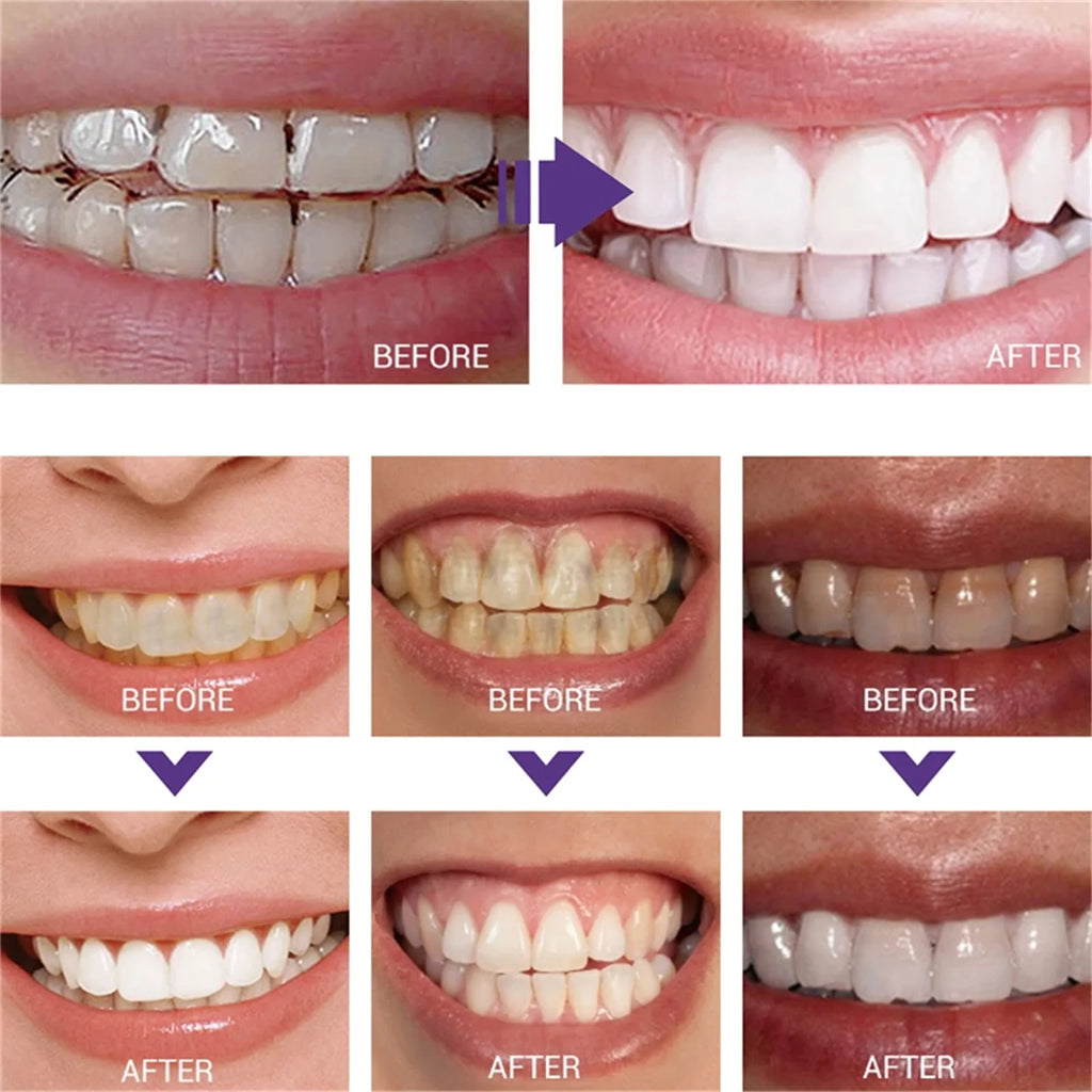 Purple Teeth Care Solution with 30g or 50g Single-Piece Options and Separate Multipack Labels for Label-Guided Adult Oral Care Product Selection