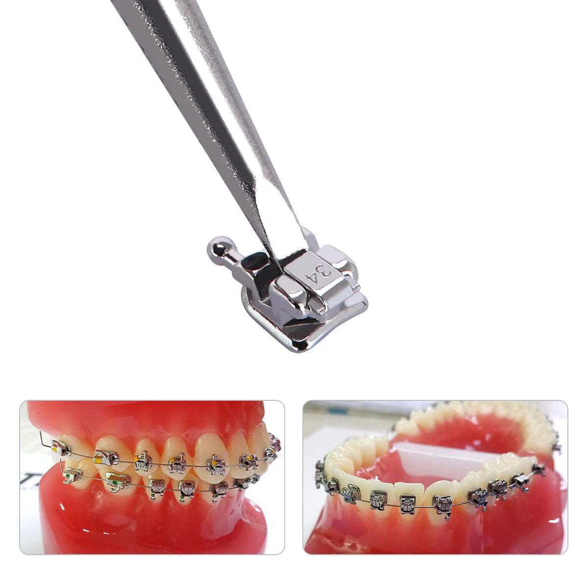 Passive Self-Ligating Brackets by AZDENT, Five Packs with First-Molar Buccal Tubes and Listed 0.022-Inch MBT or Roth Hooks 345 Options for Professional Orthodontic Selection