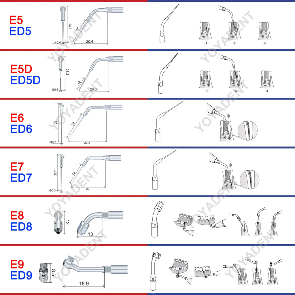 Endodontic Ultrasonic Tips and Accessory Options by Woodpecker DTE, ED-Series Model Selections with TD-1L and HD-7L Choices for Dental Equipment