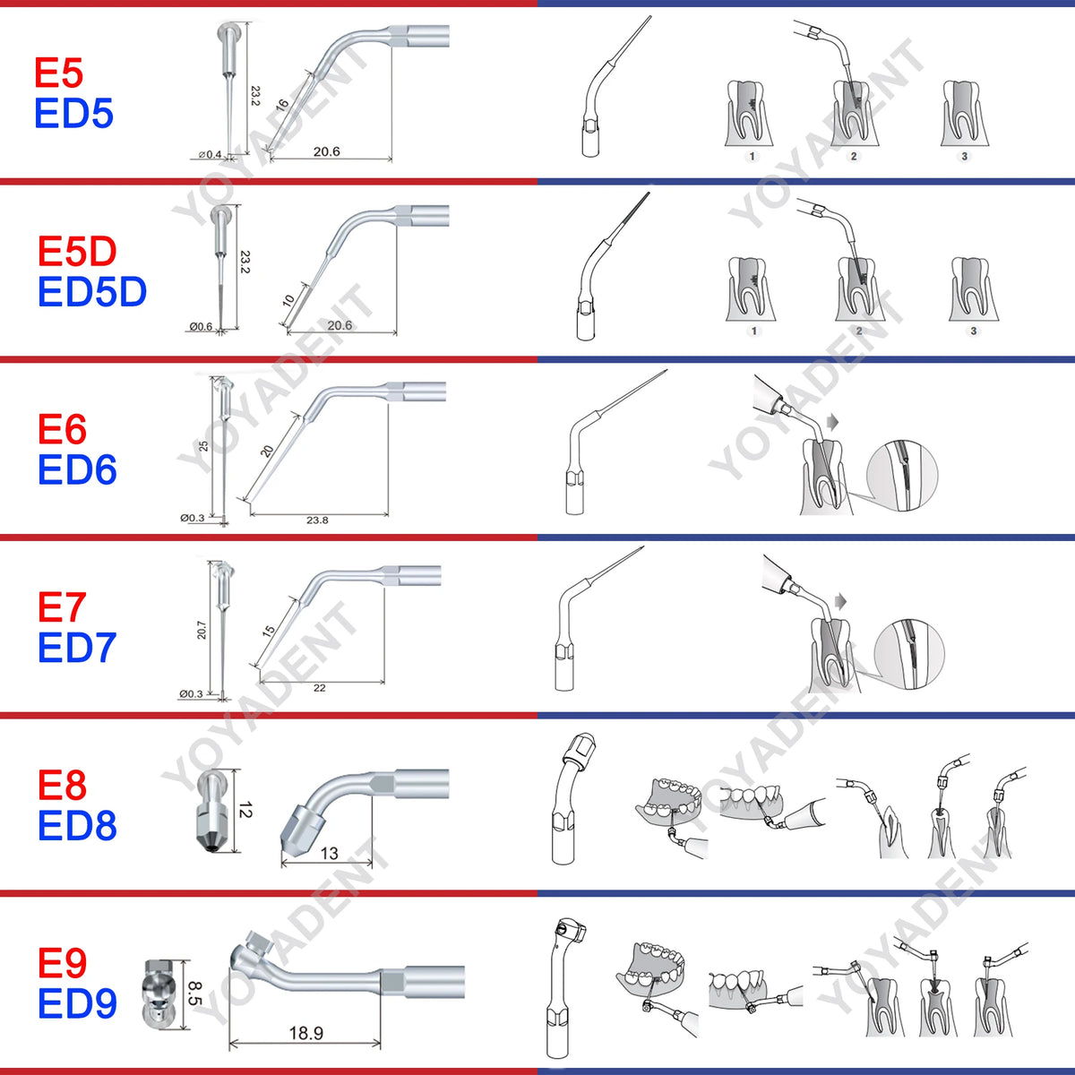 Endodontic Ultrasonic Tips and Accessory Options by Woodpecker DTE, ED-Series Model Selections with TD-1L and HD-7L Choices for Dental Equipment