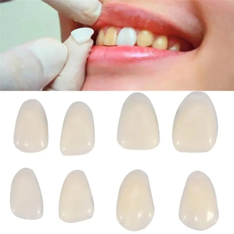 Temporary Dental Veneer Pieces for Front Teeth, Mixed-Size Cosmetic Cover Listing in Slightly White or Slightly Yellow Options for Professional Dental Review