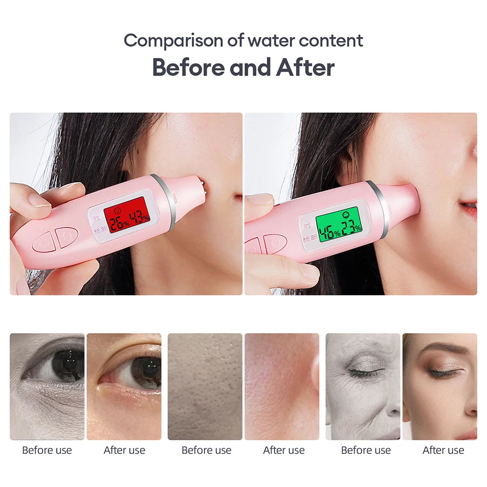 CO2 Facial Bubble Device Machine Only in White or Black, Handheld Beauty Tool with Listed Vibration, Spin and LED Modes, Compatible Care Kit Sold Separately