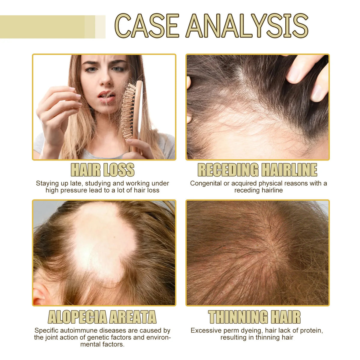 Rosemary Cosmetic Hair Oil by EELHOE with 60ml Boxed Selection, Hair and Scalp Grooming Oil for Label-Guided Home Care Routines with Additional Pack Options