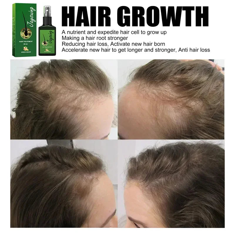 Hair Care Serum with Ginger Reference, Listed 30ml Scalp and Hair Grooming Product for Men and Women, At-Home Personal Care Routine