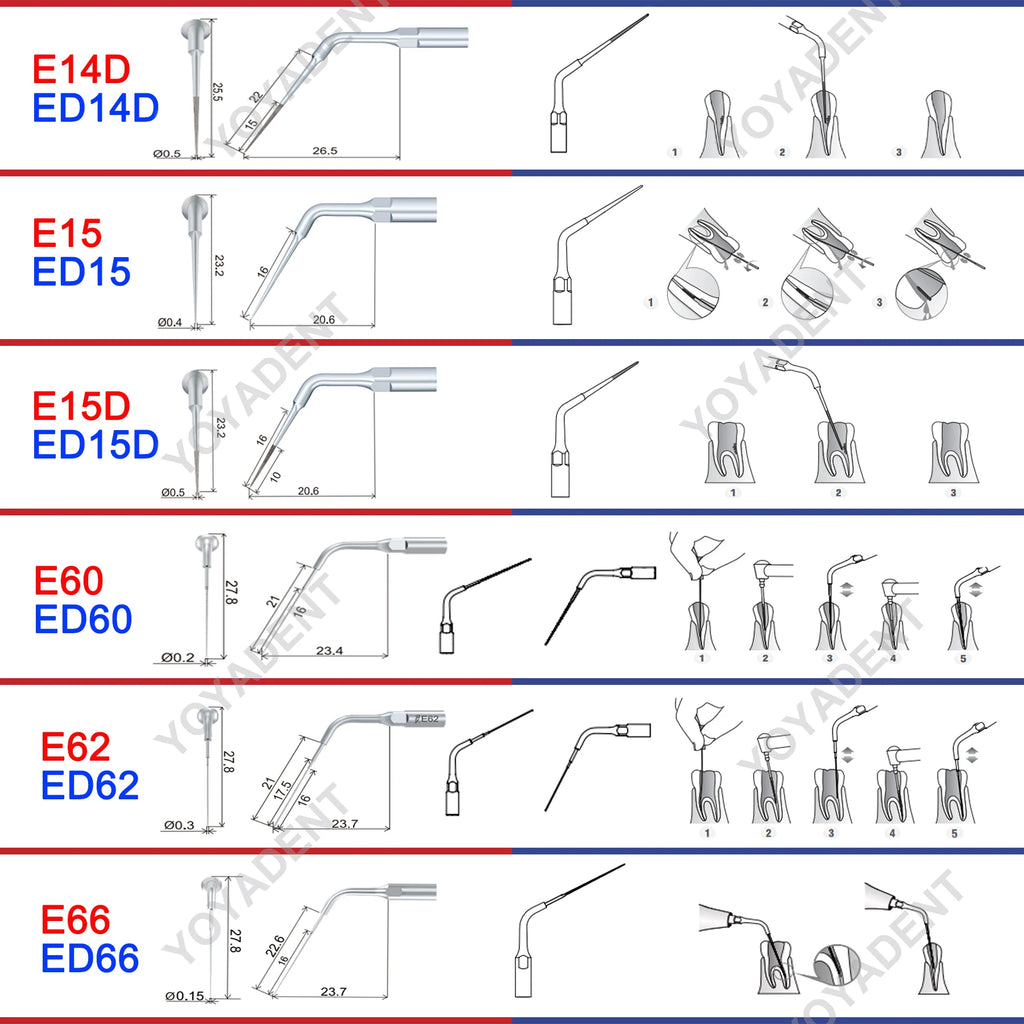 Endodontic Ultrasonic Tips and Accessory Options by Woodpecker DTE, ED-Series Model Selections with TD-1L and HD-7L Choices for Dental Equipment