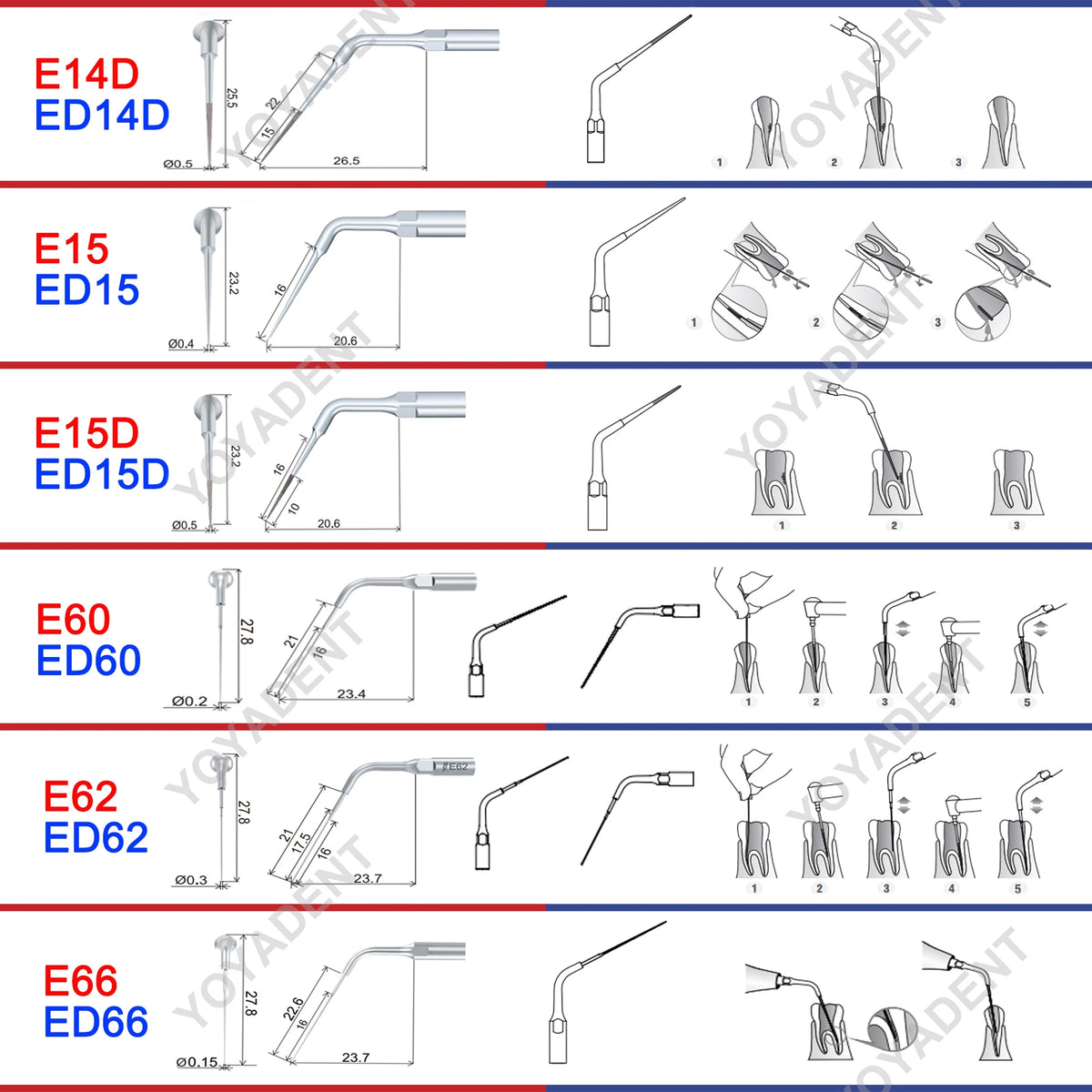 Endodontic Ultrasonic Tips and Accessory Options by Woodpecker DTE, ED-Series Model Selections with TD-1L and HD-7L Choices for Dental Equipment