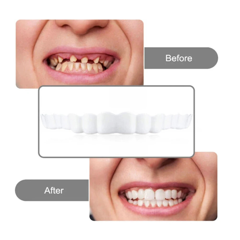 White Cosmetic Teeth Cover, Temporary False-Teeth Appearance and Denture-Style Listing with Material, Fit and Retention Requiring Professional Dental Review