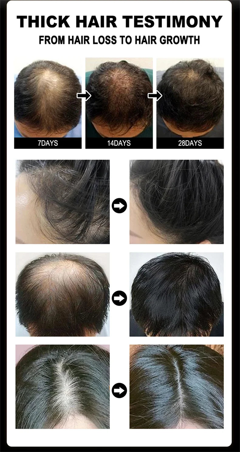 Ginger Hair Oil with Scalp and Shampoo Routine References, Cosmetic Hair Care Serum for Women and Men with Single and Promotional Purchase Options